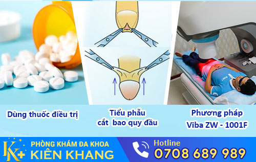 Phương pháp hỗ trợ điều trị đau nhức dương vật hiệu quả