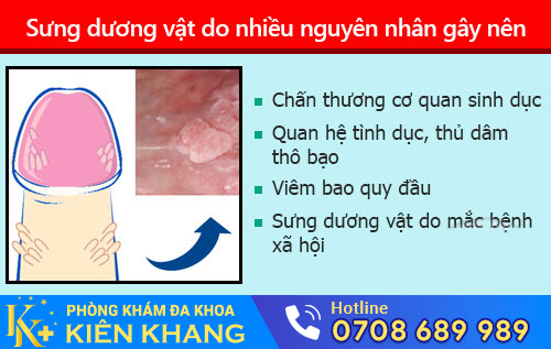 Sưng dương vật do nhiều nguyên nhân gây nên