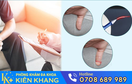Tiểu phẫu cắt bao quy đầu giúp nam giới hết bị dài bao quy đầu