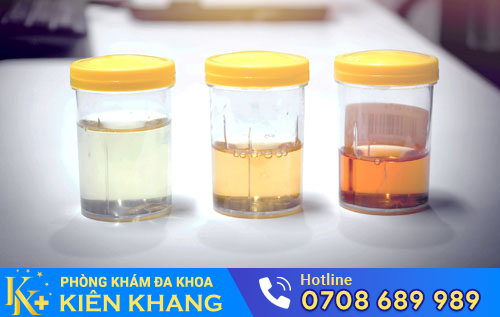 Tiểu ra máu