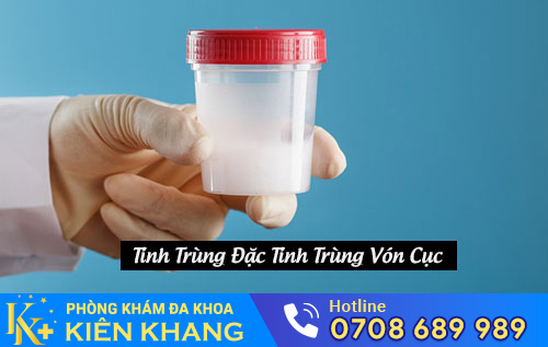 Tinh trùng đặc, tinh trùng vón cục
