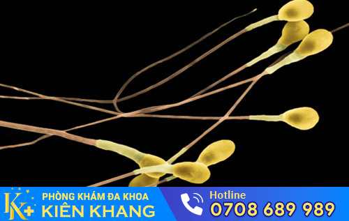 Tinh trùng màu vàng