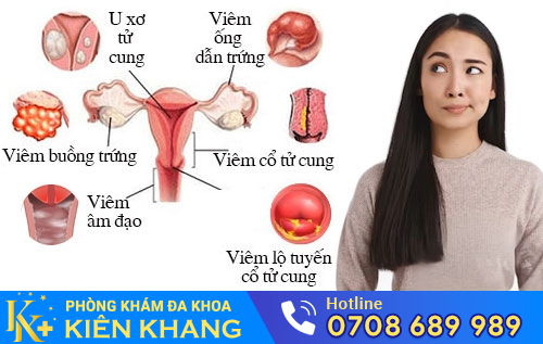 Một số bệnh phụ khoa thường gặp ở nữ giới
