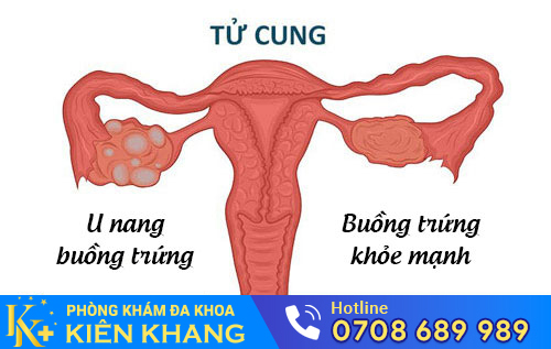 Nguyên nhân đau rát khi quan hệ