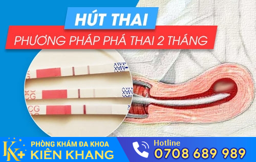 Hút thai – phương pháp phá thai 2 tháng an toàn