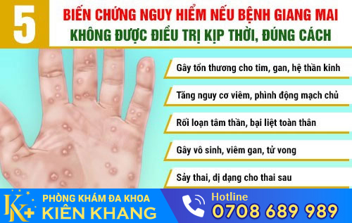 Biến chứng bệnh giang mai