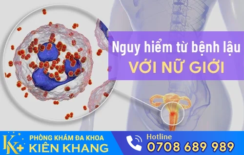 nguy hiem tu benh lau voi nu gioi