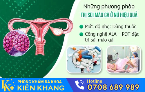 Phòng Khám Đa Khoa Kiên Khang - địa chỉ chữa sùi mào gà ở cổ tử cung uy tín