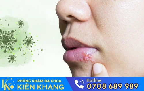 sui mao ga o mieng