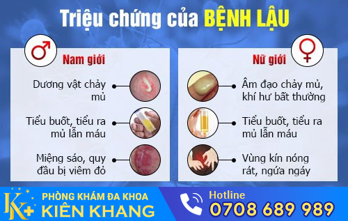 Triệu chứng của bệnh lậu