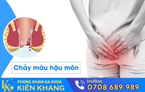 Chảy máu hậu môn