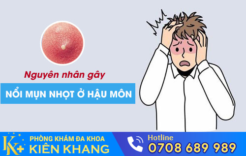 Nổi mụn nhọt ở hậu môn