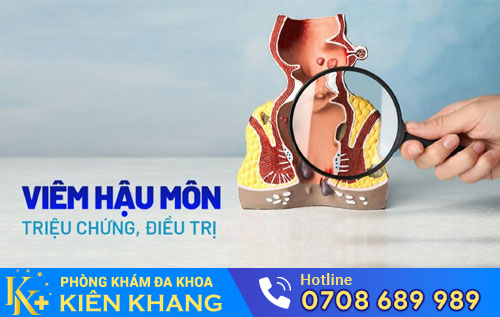Viêm hậu môn