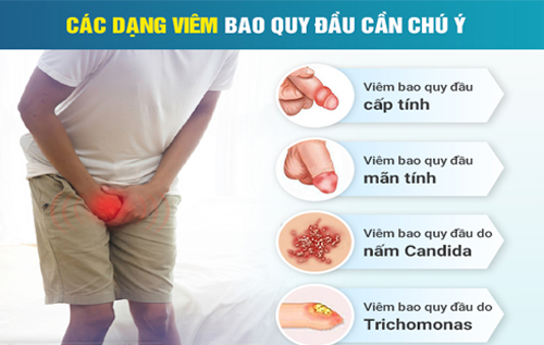 Cách chữa trị viêm bao quy đầu hiệu quả tốt tại Phòng Khám kiên Khang