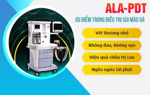 Quang động lực ALA - PDT hỗ trợ điều trị sùi mào gà