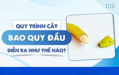 Quy trình cắt bao quy đầu